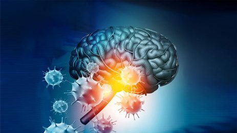 COVID-19 Doğrudan Beyin Hasarına Sebep Oluyor mu?