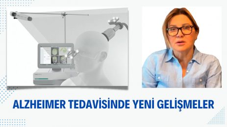 Alzheimer Tedavisinde Yeni Gelişmeler