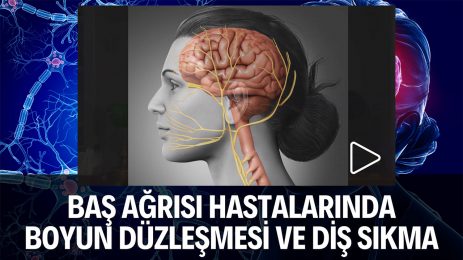 Baş ağrısı hastalarında boyun düzleşmesi ve diş sıkma