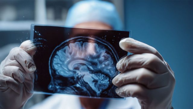 Beyin Hasarı Sonrası İyileşme Mümkün mü?