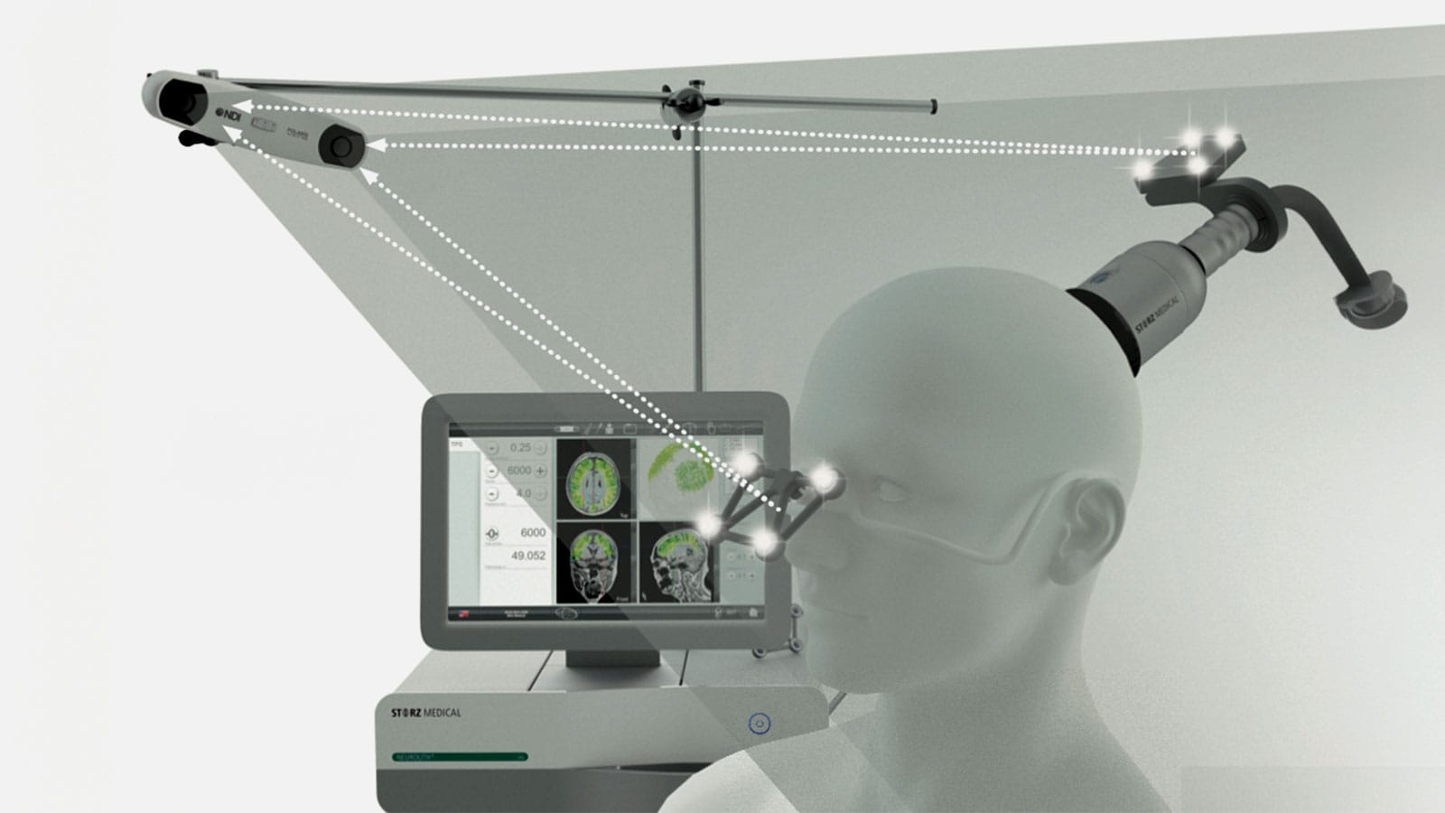 Tek başına TPS NEUROLITH tedavisi Alzheimer hastalığını iyileştimez!